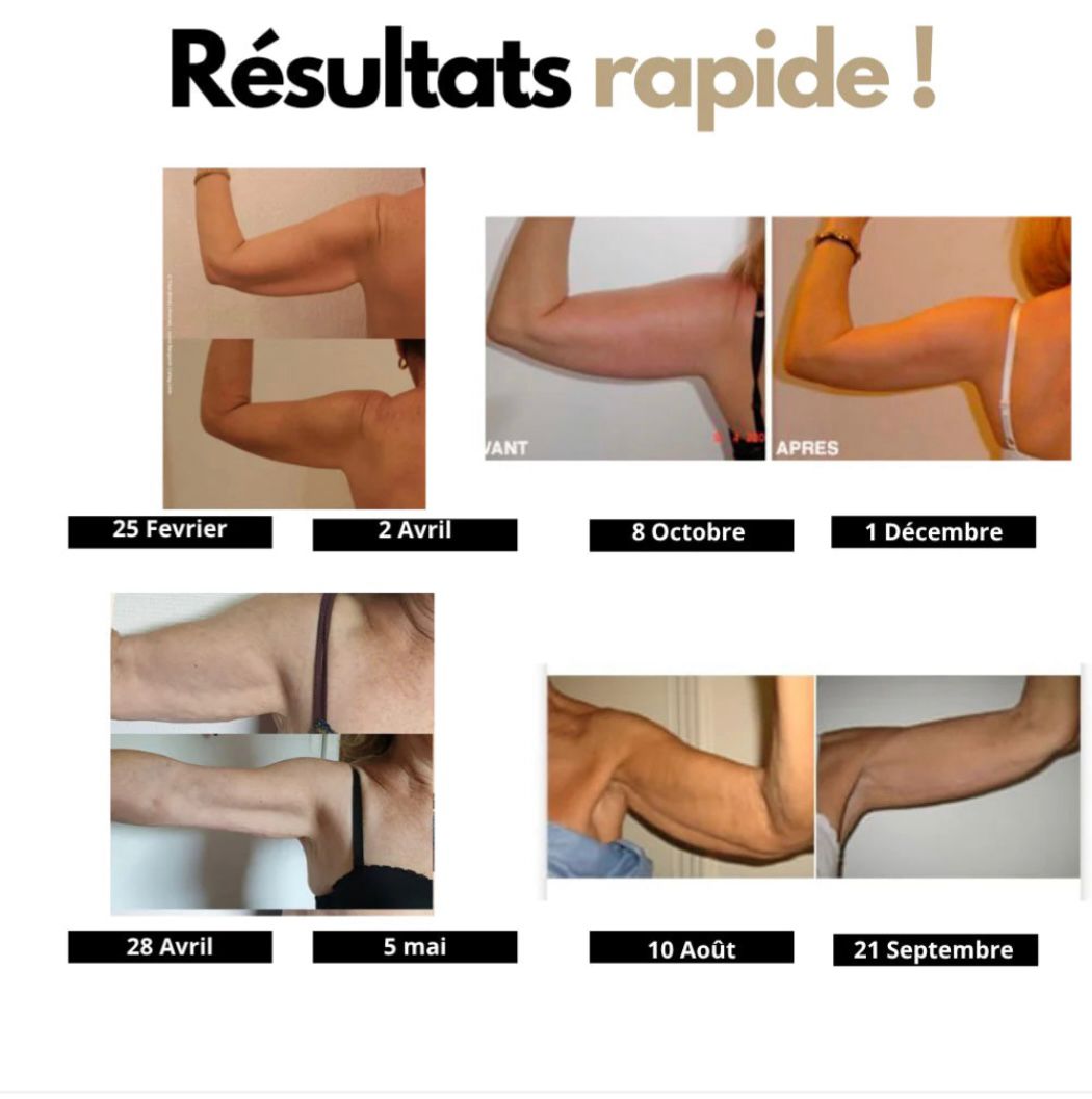 Manchons Sculptants Nuvia®